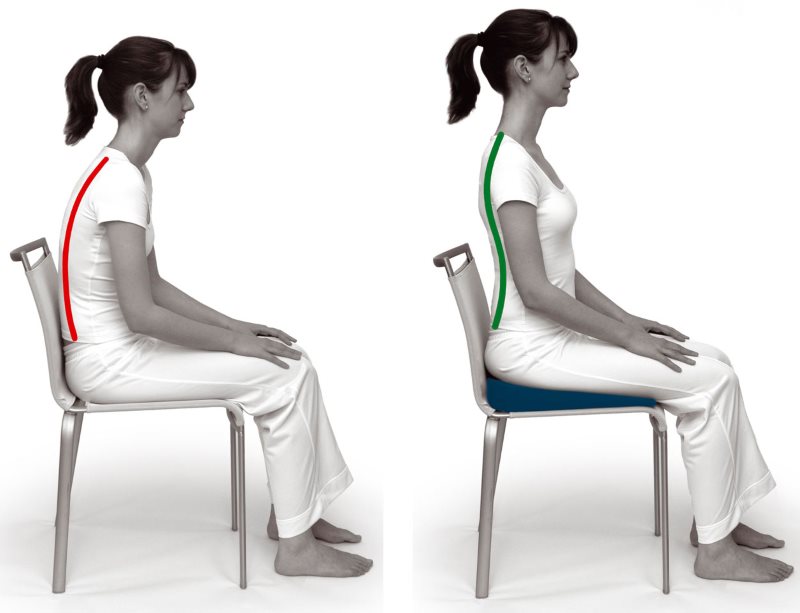 Posture correction with orthopedic pillow